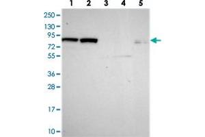 Western blot analysis of Lane 1: RT-4, Lane 2: U-251 MG, Lane 3: Human Plasma, Lane 4: Liver, Lane 5: Tonsil with DHX40 polyclonal antibody  at 1:250-1:500 dilution. (DEAH (Asp-Glu-Ala-His) Box Polypeptide 40 (DHX40) antibody)