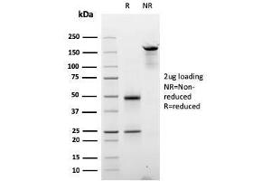SDS-PAGE Analysis Purified Cyclin D2 Mouse Monoclonal Antibody (CCND2/2620).