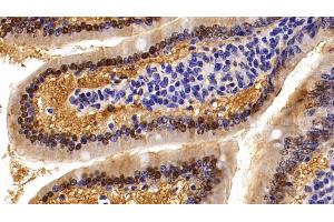 Detection of ALT in Mouse Small intestine Tissue using Polyclonal Antibody to Alanine Aminotransferase (ALT) (ALT antibody  (AA 143-417))