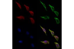 ABIN6266307 and ABIN6277426 staining Hela cells by IF/ICC. (PIBF1 antibody  (C-Term))