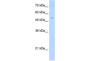 WB Suggested Anti-ZNF239 Antibody Titration:  0. (ZNF239 antibody  (Middle Region))