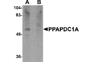 Western blot analysis of PPAPDC1A in human brain tissue lysate with PPAPDC1A antibody at 1 µg/mL in (A) the absence and (B) the presence of blocking peptide.