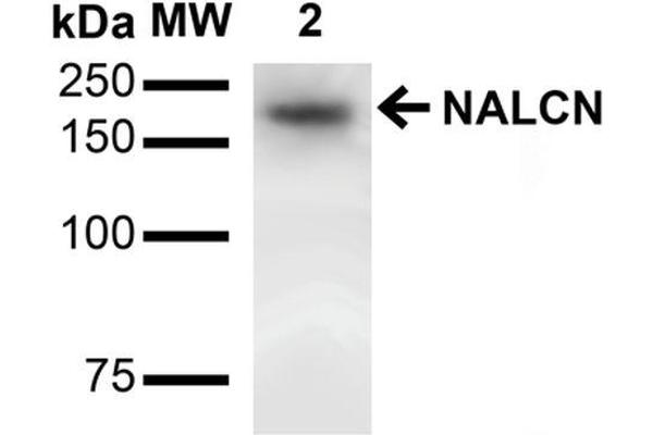 NALCN antibody  (AA 1659-1738) (FITC)
