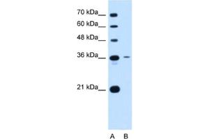 Western Blotting (WB) image for anti-Tetraspanin 5 (TSPAN5) antibody (ABIN2462995)