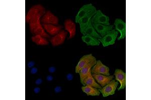 ABIN6258521 and ABIN6274743 staining Hela cells by IF/ICC.