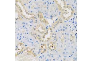 Immunohistochemistry of paraffin-embedded rat kidney using DNAL1 antibody (ABIN5974658) at dilution of 1/100 (40x lens).