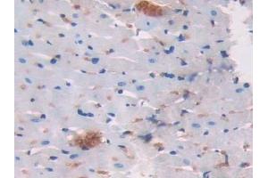 Detection of LCNL1 in Rat Heart Tissue using Polyclonal Antibody to Lipocalin Like Protein 1 (LCNL1) (LCNL1 antibody)