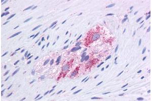 Human Colon, Myenteric Plexus: Formalin-Fixed, Paraffin-Embedded (FFPE) (GLUD1 antibody  (AA 182-231))