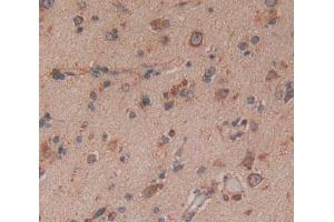 Used in DAB staining on fromalin fixed paraffin- embedded Kidney tissue (NTRK3 antibody  (AA 32-429))