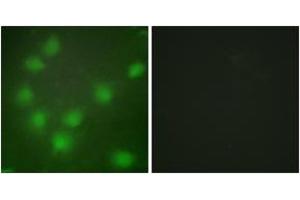 Immunofluorescence analysis of HuvEc cells, using HOXA11/D11 Antibody. (HOXA11/D11 antibody  (AA 216-265))