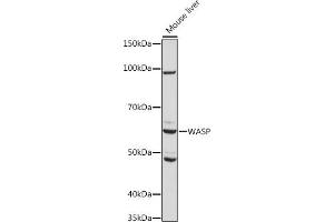 Western blot analysis of extracts of Mouse liver, using WASP Rabbit mAb (ABIN7271381) at 1:1000 dilution. (WASP antibody)
