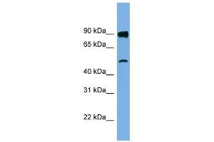 FAM160B1 antibody used at 1 ug/ml to detect target protein. (FAM160B1 antibody  (N-Term))