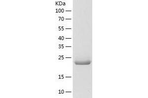 Western Blotting (WB) image for NFU1 Iron-Sulfur Cluster Scaffold (NFU1) (AA 10-254) protein (His tag) (ABIN7124166) (NFU1 Protein (AA 10-254) (His tag))