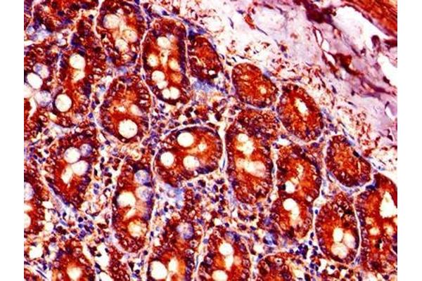 PFDN5 antibody  (AA 2-154)