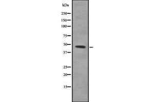 Western blot analysis of PBX3 using K562 whole cell lysates (PBX3 antibody  (N-Term))