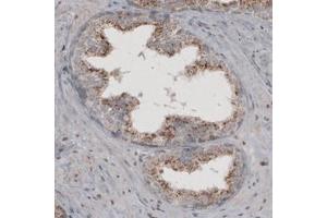 Immunohistochemical staining (Formalin-fixed paraffin-embedded sections) of human prostate with ACAA1 monoclonal antibody, clone CL2662  shows granular cytoplasmic immunoreactivity in glandular cells.