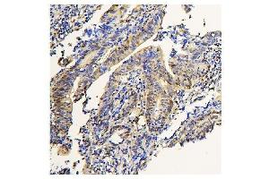IHC analysis of ADK using anti-ADK antibody (ABIN7600222). (ADK antibody  (AA 165-351))