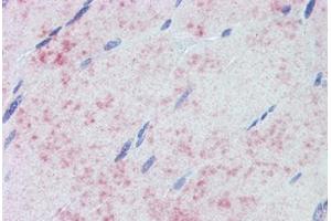 Skeletal muscle. (PDPK1 antibody)