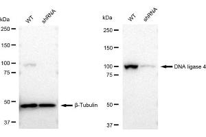 Western blotting analysis using DNA ligase 4 antibody (ABIN7799266).