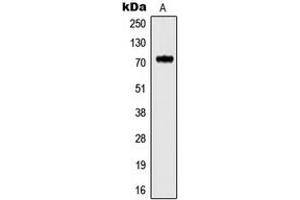 Western blot analysis of Kv3. (Kv3.4 antibody  (N-Term))
