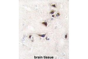 Immunohistochemistry (IHC) image for anti-Calcium/calmodulin-Dependent Protein Kinase II alpha (CAMK2A) antibody (ABIN3003046) (CAMK2A antibody)