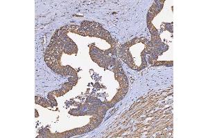 IHC analysis of HSD11B2 using anti-HSD11B2 antibody (ABIN7602698).