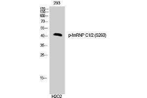 Western Blotting (WB) image for anti-Heterogeneous Nuclear Ribonucleoprotein C (C1/C2) (HNRNPC) (pSer260) antibody (ABIN3173285) (HNRNPC antibody  (pSer260))