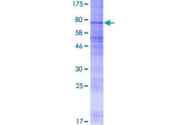 SSTR3 Protein (AA 1-418) (GST tag)