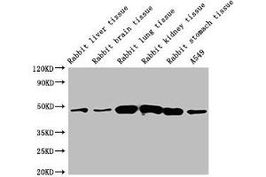 Western Blot Positive WB detected in: Rabbit liver tissue, Rabbit brain tissue, Rabbit lung tissue, Rabbit kidney tissue, Rabbit stomach tissue, A549 whole cell lysate All lanes: ACTB antibody at 1:5000 Secondary Goat polyclonal to mouse IgG at 1/50000 dilution Predicted band size: 42 KDa Observed band size: 42 KDa Exposure time: 5 min (beta Actin antibody  (AA 1-50))