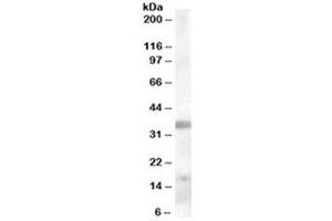 Western blot testing of human tonsil lysate with TIM-3 antibody at 0. (TIM3 antibody)