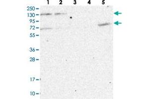 Western blot analysis of Lane 1: RT-4, Lane 2: U-251 MG, Lane 3: Human Plasma, Lane 4: Liver, Lane 5: Tonsil with MATR3 polyclonal antibody . (MATR3 antibody)