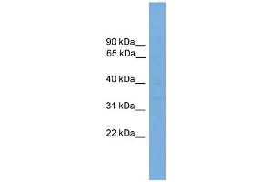 WB Suggested Anti-PIM2 Antibody Titration: 0. (PIM2 antibody  (Middle Region))