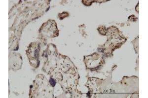 Image no. 3 for anti-Zic Family Member 4 (ZIC4) (AA 249-320) antibody (ABIN466252) (ZIC4 antibody  (AA 249-320))