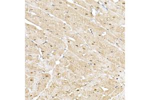 Immunohistochemistry of paraffin-embedded rat heart using PSM Rabbit pAb (752) at dilution of 1:50 (40x lens). (PSMA5 antibody  (AA 1-241))