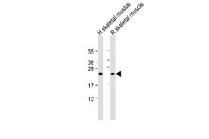 All lanes : Anti-MYL1 Antibody (N-Term) at 1:2000 dilution Lane 1: Human skeletal muslce lysate Lane 2: Rat skeletal muscle lysate Lysates/proteins at 20 μg per lane. (MYL1 antibody  (AA 24-58))