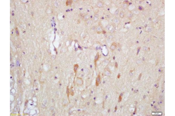 SLITRK1 antibody  (AA 21-120)