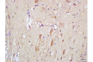 Formalin-fixed and paraffin embedded rat brain labeled with Rabbit Anti-Slitrk1 Polyclonal Antibody, Unconjugated (ABIN715556) at 1:200 followed by conjugation to the secondary antibody and DAB staining (SLITRK1 antibody  (AA 21-120))
