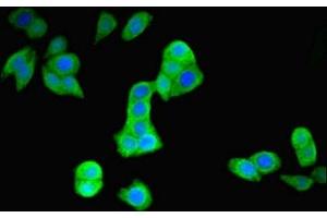 Immunofluorescence (IF) image for anti-Parkinson Protein 2, E3 Ubiquitin Protein Ligase (Parkin) (PARK2) (AA 1-465) antibody (ABIN7151093)