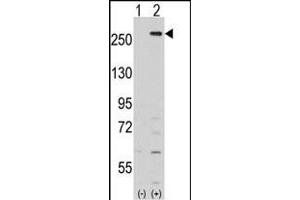 Western blot analysis of LMTK2 (arrow) using rabbit polyclonal LMTK2 Antibody (Center) (ABIN391210 and ABIN2841289). (LMTK2 antibody  (AA 668-697))