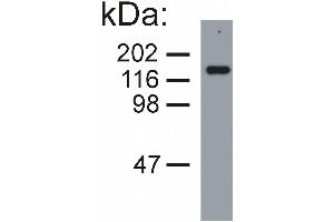 Western blotting analysis of neurofilament medium protein in porcine brain lysate (reducing conditions) by mouse monoclonal NF-09. (NEFM antibody)