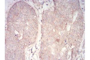 Immunohistochemistry (IHC) image for anti-3-phosphoinositide Dependent Protein Kinase-1 (PDPK1) (AA 457-556) antibody (ABIN5855659) (PDPK1 antibody  (AA 457-556))