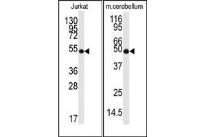 Image no. 1 for anti-Enolase 2 (Gamma, Neuronal) (ENO2) antibody (ABIN357944) (ENO2/NSE antibody)