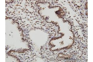 Immunoperoxidase of monoclonal antibody to SP1 on formalin-fixed paraffin-embedded human endometrium. (SP1 antibody  (AA 89-198))