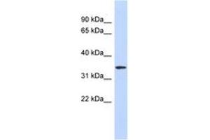 Image no. 1 for anti-Olfactory Receptor, Family 13, Subfamily C, Member 5 (OR13C5) (AA 71-120) antibody (ABIN6742326) (OR13C5 antibody  (AA 71-120))