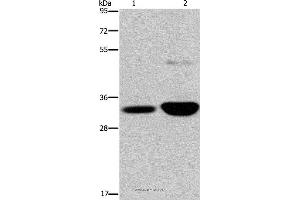 Western blot analysis of Human fetal brain and mouse brain tissue, using MAPRE3 Polyclonal Antibody at dilution of 1:500 (MAPRE3 antibody)
