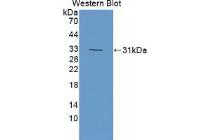 Figure. (DOK7 antibody  (AA 63-320))