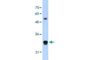 Western Blot analysis of HepG2 cell lysate with IGSF1 polyclonal antibody  at 1.