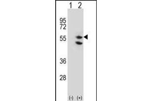 Western blot analysis of TUFM (arrow) using rabbit polyclonal TUFM Antibody (C-term) (ABIN656840 and ABIN2846048). (TUFM antibody  (C-Term))