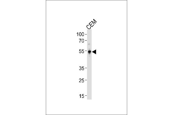 KLF5 antibody  (C-Term)