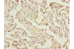Immunohistochemistry of paraffin-embedded human lung tissue using ABIN7175170 at dilution of 1:100 (RAD23A antibody  (AA 2-201))